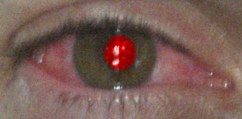 File:User Bermudezis2005 Red eye.png
