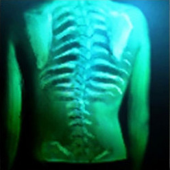 File:Spinal Shivers (large).jpg